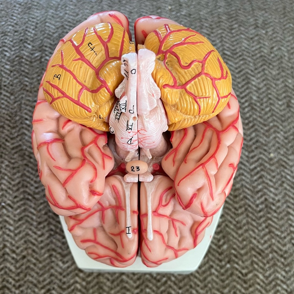 Vintage Model of Human Brain - Picture 1 of 6